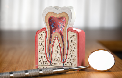 Root Canal Treatment