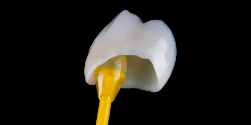 Dental Crowns